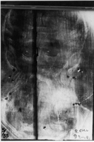 X-ray Image